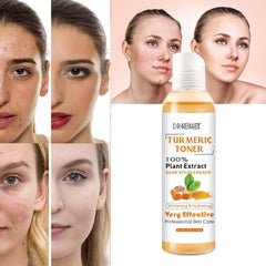 Turmeric Moisturizing Toner Acne Remover