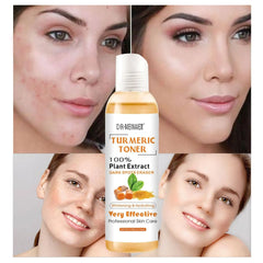 Turmeric Moisturizing Toner Acne Remover